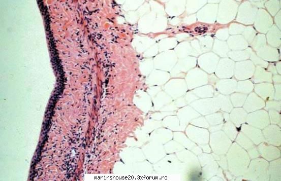 Histologie - mitza - Pozele diverse