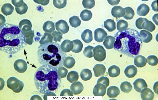 Histologie - mitza - Pozele diverse