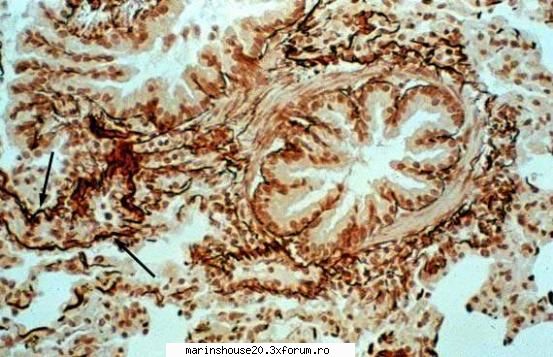 Histologie - mitza - Pozele diverse