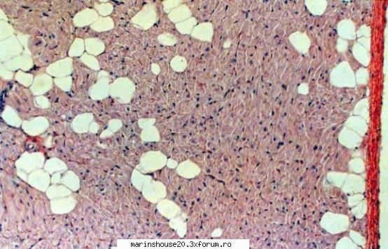 Histologie - mitza - Pozele diverse