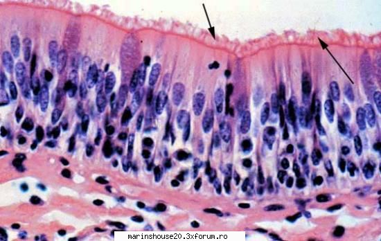 Histologie - mitza - Pozele diverse