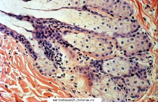 Histologie - mitza - Pozele diverse