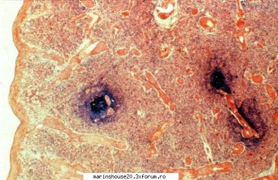 Histologie - mitza - Pozele diverse