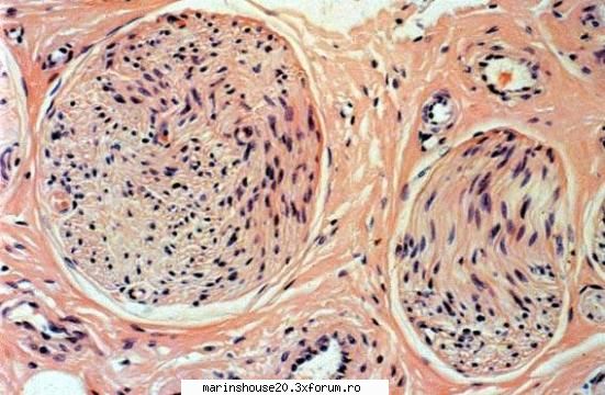 Histologie - mitza - Pozele diverse