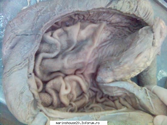 Splahnologie (stomac si intestine) - marinshouse20 - Pozele diverse