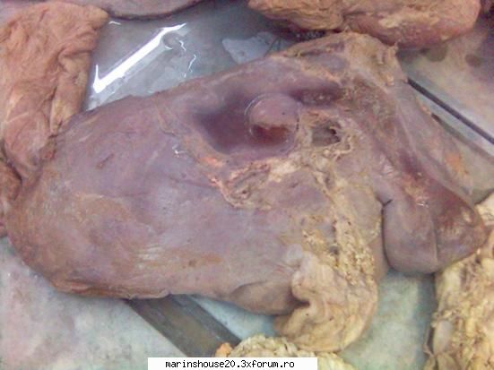 .. (stomac si intestine)